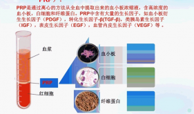 PRP新疗法——伤口愈合的福音