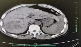 争分夺秒，为生命保驾护航
