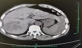 争分夺秒，为生命保驾护航